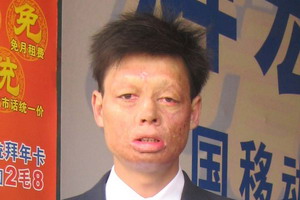 陈化东：为什么社会不接纳我？