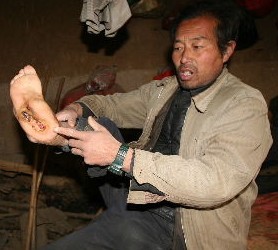 心比天高，命比纸薄的李永政爱心捐款明细